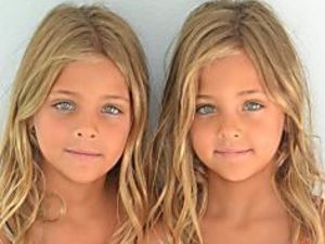 These Twins Were Named "Most Beautiful in the World," Wait Til You See Them Now